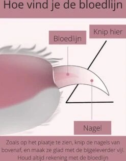 Professionele Nagelschaar | Nagelschaar Hond | Nagelschaar Kat | Nagelknipper Hond En Kat | Nagelknipper Kat| Nagelknipper Hond | NagelTang Dieren | Poot Verzorging -Hondenartikelen Winkel 942x1200 5